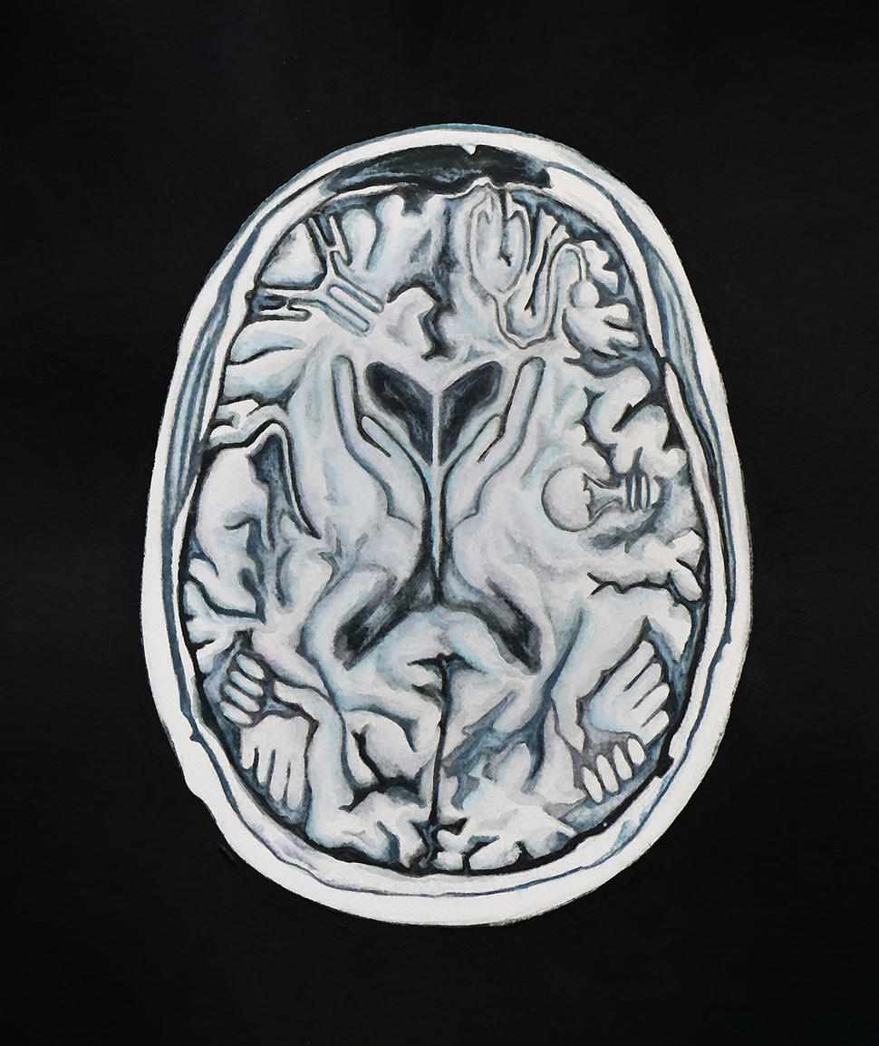 Painting of an MRI brain scan with pairs hands holding one another, a mouse, a stethoscope, a lightbulb and a heart hidden in the brain's tissue folds
