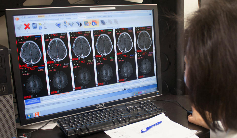 Over-the-shoulder shot of clinician at a computer screen looking at brain MRIs