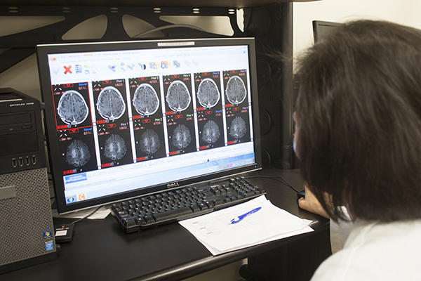 Fotografía tomada por encima del hombro de un médico que observa en una computadora las resonancias magnéticas del cerebro.