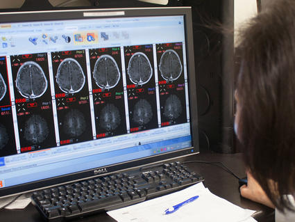 Over-the-shoulder shot of clinician at a computer screen looking at brain MRIs