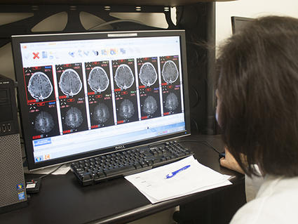 Fotografía tomada por encima del hombro de un médico que observa en una computadora las resonancias magnéticas del cerebro.