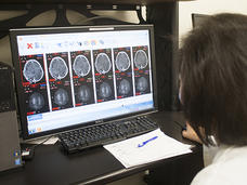 Brain tumor scans