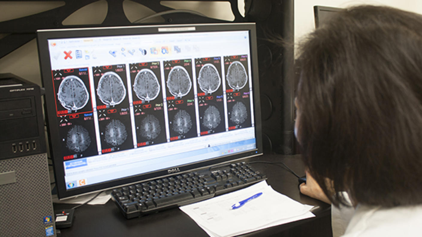 Fotografía tomada por encima del hombro de un médico que observa en una computadora las resonancias magnéticas del cerebro.