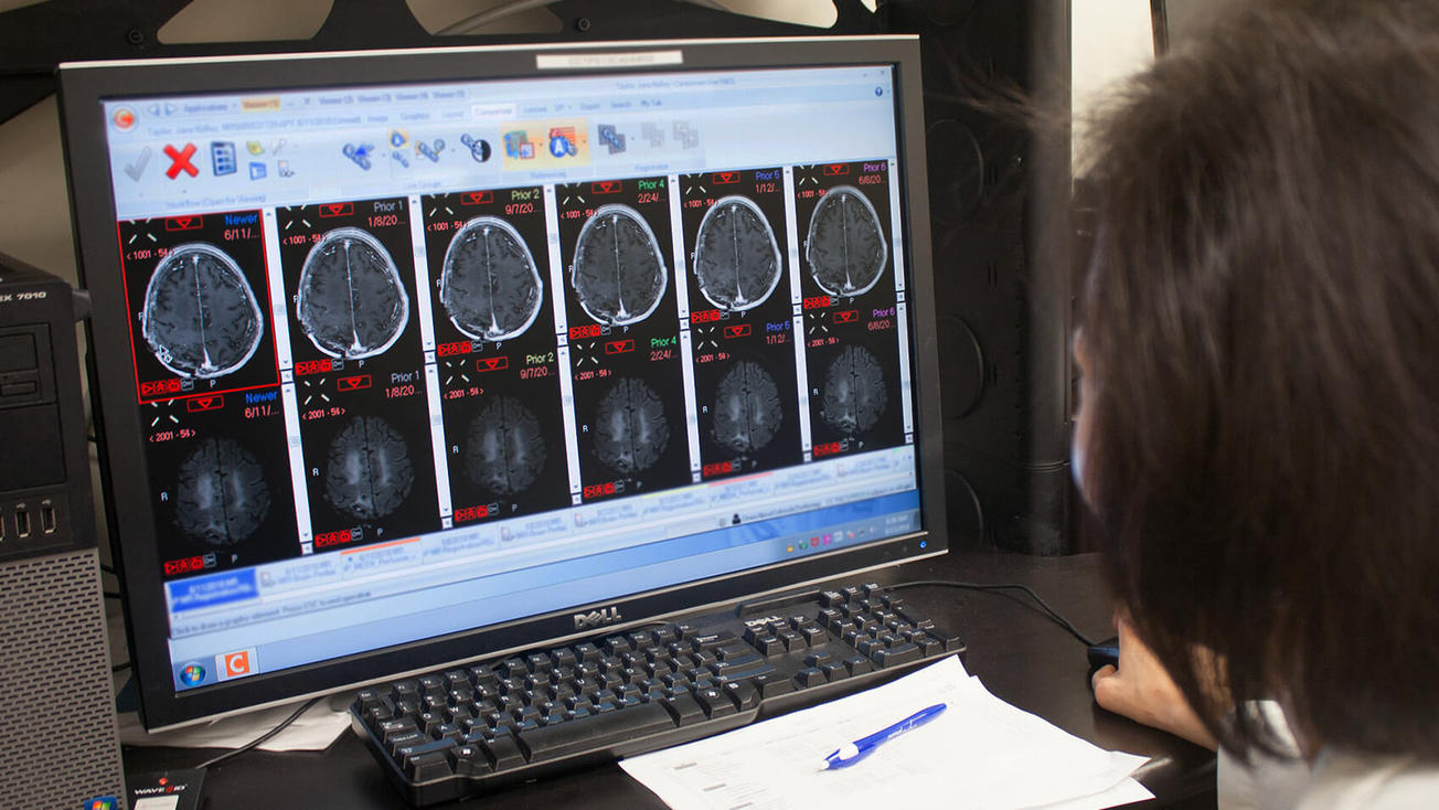 Over-the-shoulder shot of clinician at a computer screen looking at brain MRIs