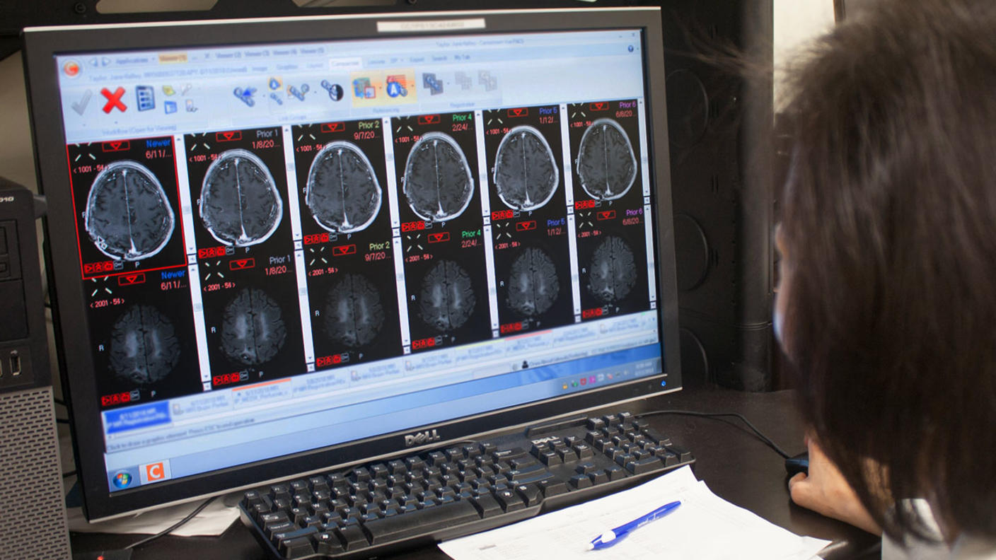 Over-the-shoulder shot of clinician at a computer screen looking at brain MRIs