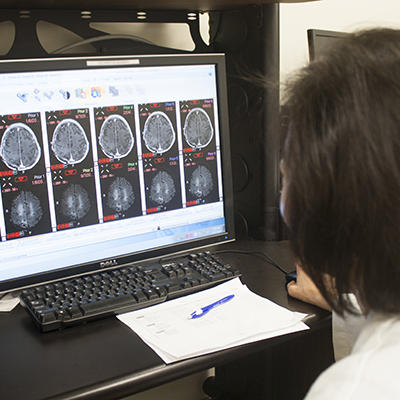 Fotografía tomada por encima del hombro de un médico que observa en una computadora las resonancias magnéticas del cerebro.