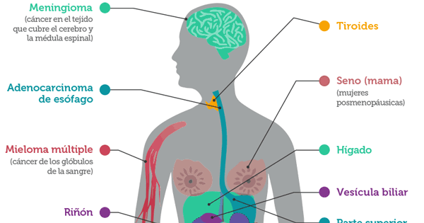 Canceres Asociados Con Obesidad Y Sobrepeso Instituto Nacional Del Cancer