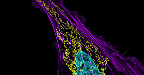 Primary Bone Cancer - National Cancer Institute