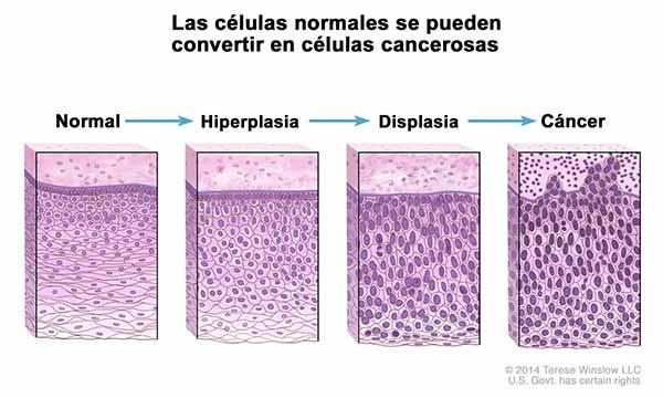 Biologia celulara a cancerului - Corneliu Dorin Olinici