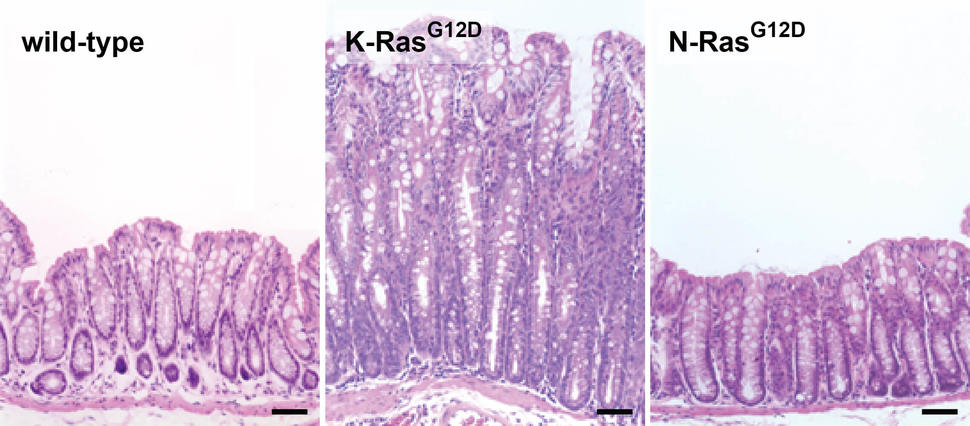 A three-panel collage of cell slide images. The left is labeled “wild-type”, the middle “K-Ras G12D”, and the right “N-Ras G12D”. The left and right images are mostly similar, purple and pink with some small white areas. Their height is about a third of the panel. The middle image is similarly colored but more muted and takes up the height of the panel, with more white areas.