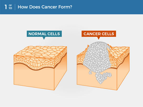 5 paragraph essay on cancer