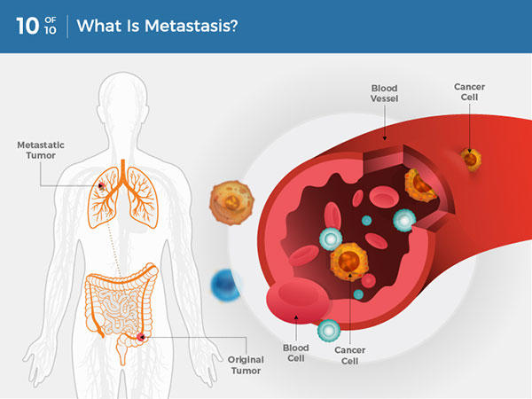 essay about cancer biology