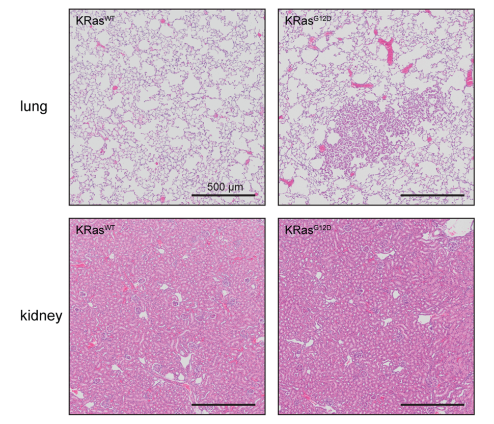 A comparison of histology between lung and kidney tissue with and without KRAS G12D mutations. Lung tissue develops hyperplastic lesions with the mutation whereas kidney tissue does not.