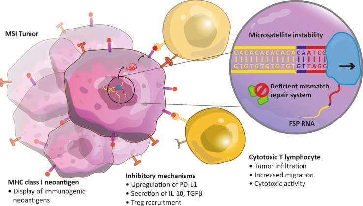 metastatic cancer immunotherapy