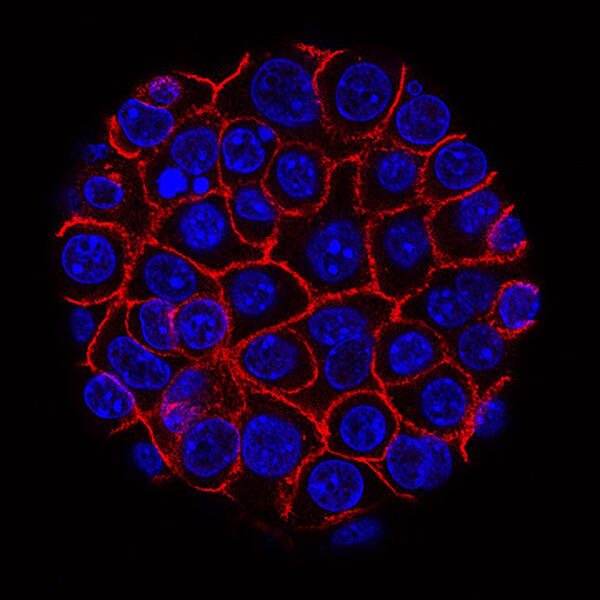 Pancreatic cancer cells growing in a sphere-shaped cluster.