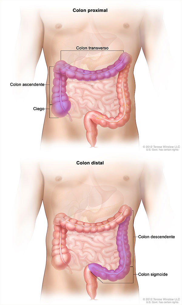 Cancer de colon pronostico