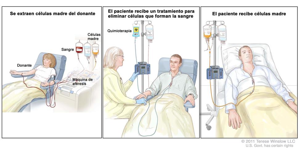 Cancer de colon quimioterapia. Cancer de colon espalda - Hyrina Díaz, Cancer de colon quimioterapia