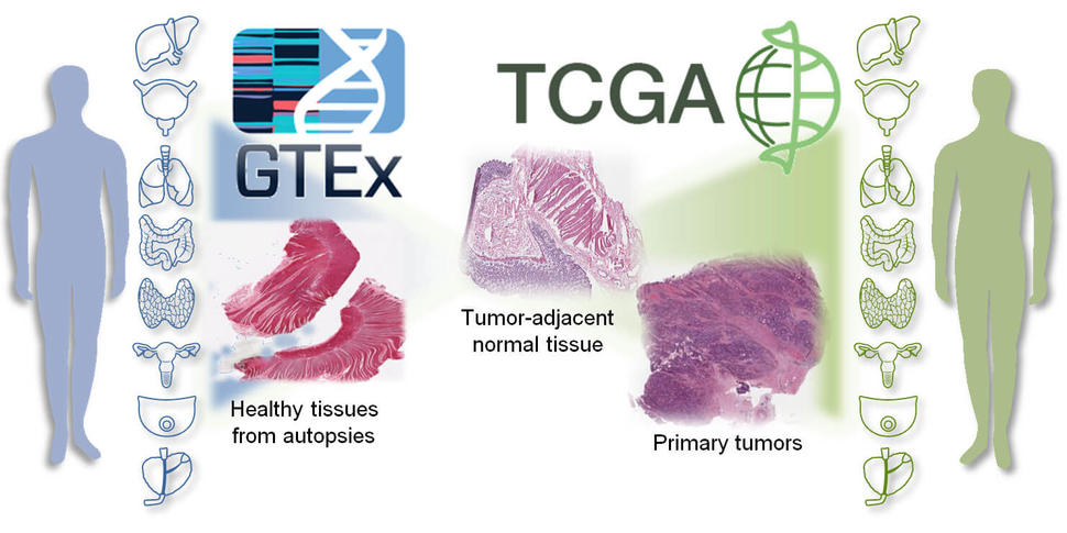 cancer benign tissue