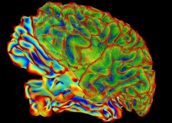 what is cholesterol on the brain