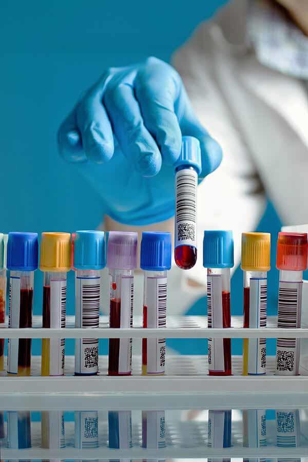 Gloved hand picking up a capped vial of blood from a tray holding additional capped vials.