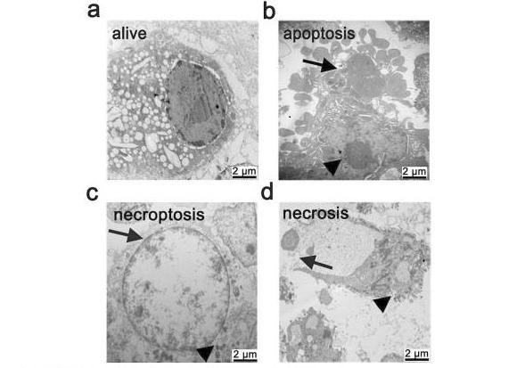 Microscope images showing a live cell and cells undergoing apoptosis, necroptosis, and necrosis.