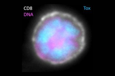 Image of an exhausted T cell with blue staining showing TOX in the cell nucleus.