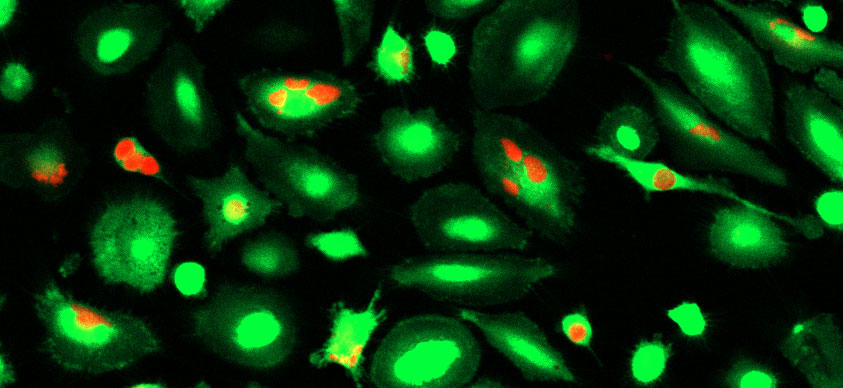 Microscope images of macrophage immune cells that have engulfed breast cancer cells treated with a CD24-blocking antibody.