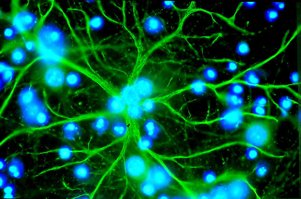 An astrocyte in culture emitting long, winding extensions.