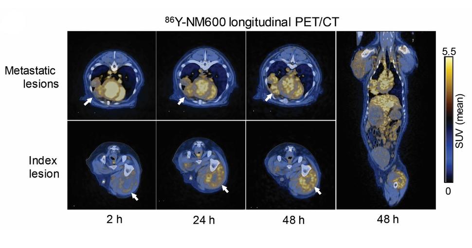 A series of PET/CT scans of a dog after receiving molecular radiation therapy show the uptake of radiation by the targeted tumor and other tumors in the body.