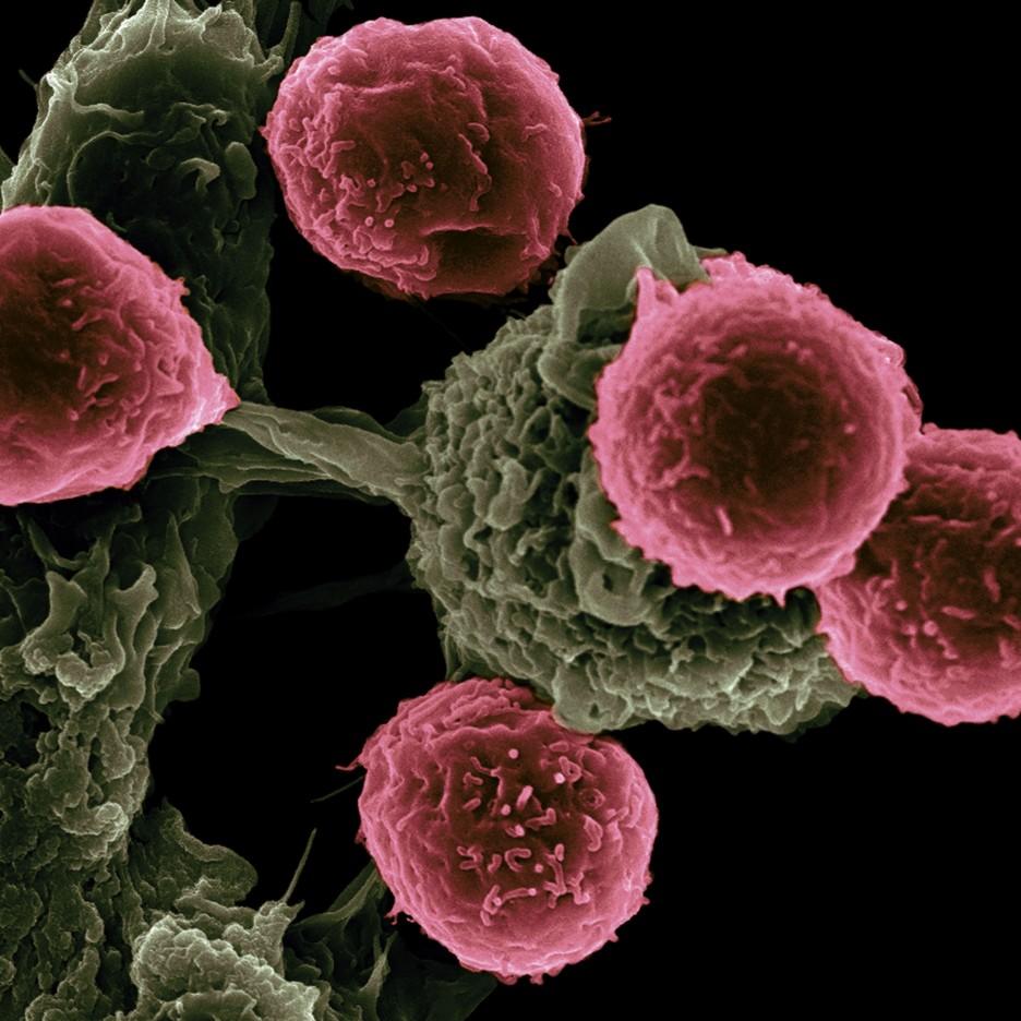 This scanning electron microscope image shows dendritic cells, colored in green, interacting with T cells, colored in pink. 