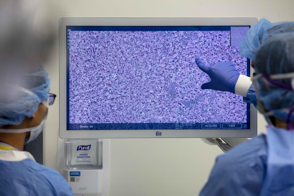 Image of surgical staff reviewing an image of a brain tumor biopsy.