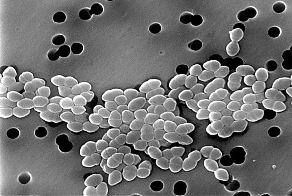 Vancomycin Resistant Enterococcus