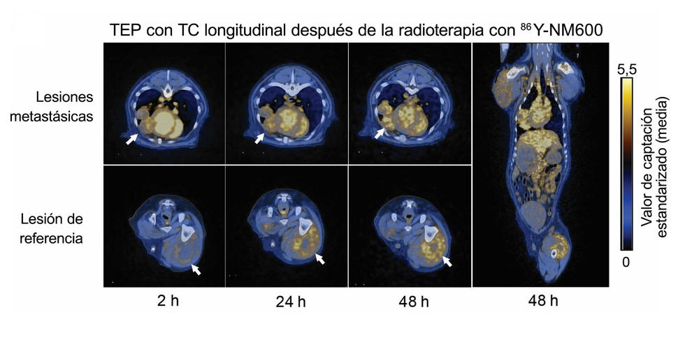 Serie de TEP-TC de un perro después de recibir radioterapia molecular. Se observa el tumor tratado y la absorción de la radiación en otros tumores del cuerpo.