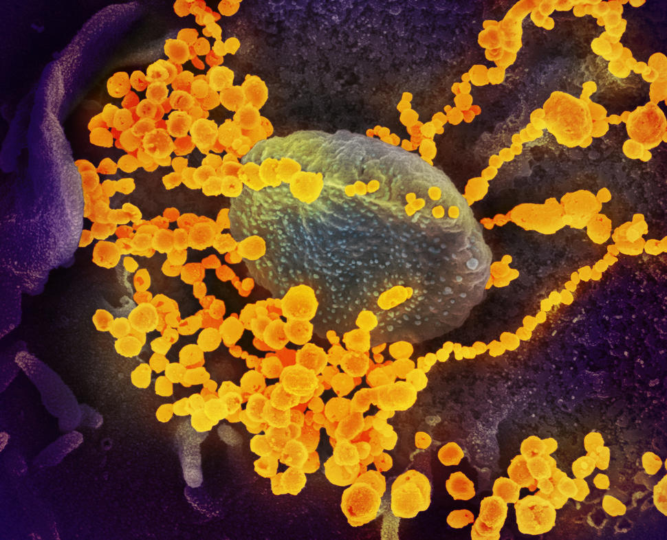 Microscope image of gold-colored virus particles