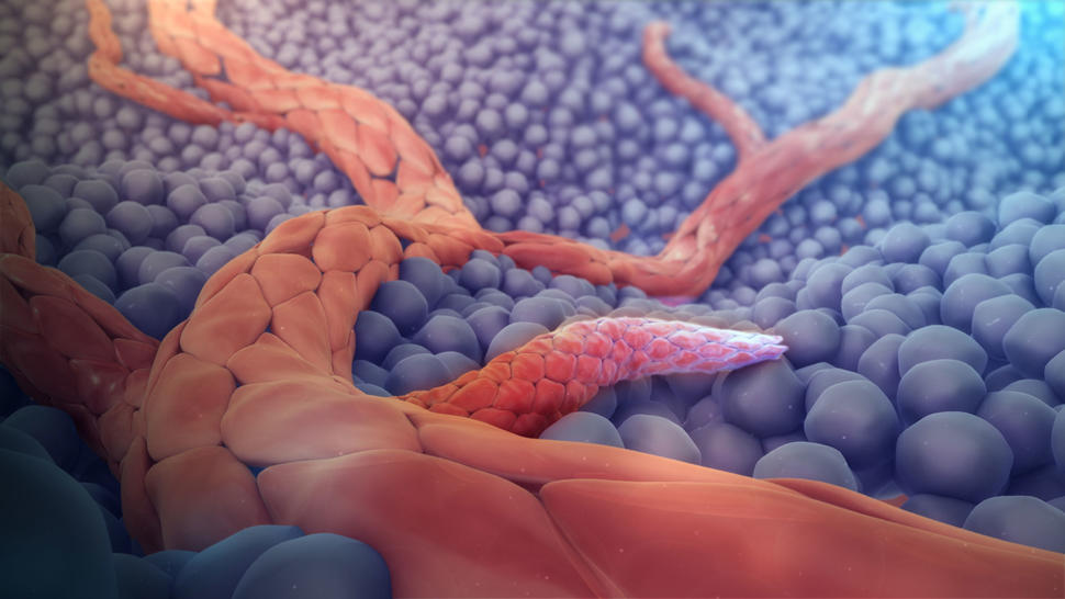 Angiogenesis medical animation still