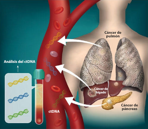 Imagen en la que se observa el ADN que se separa de los tumores y circula en la sangre.