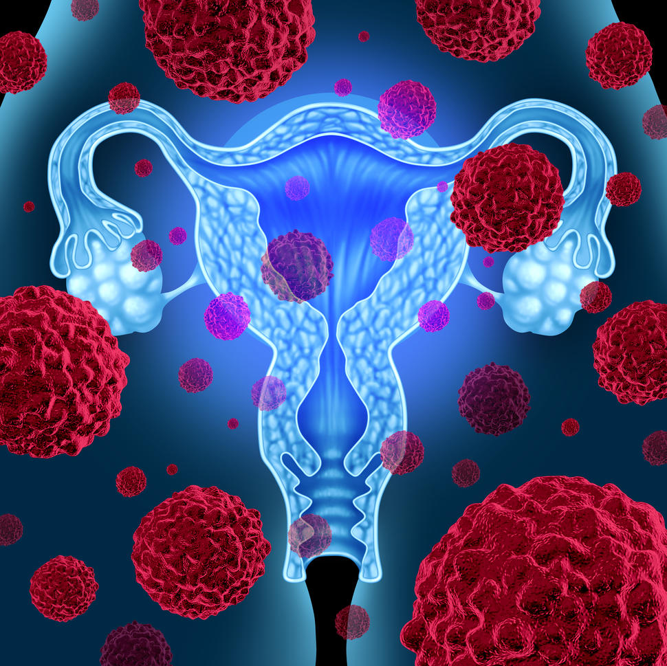 Drawing of targeted therapy surrounding the female reproductive system, including the uterus and endometrium.