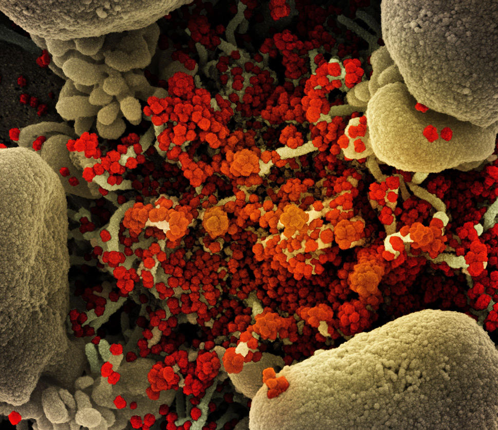 Molecular image of SARS CoV 2