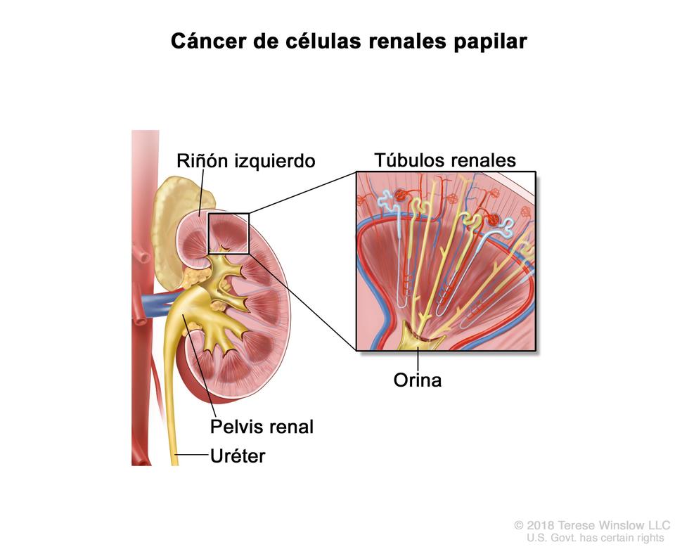 En la imagen se observan el riñón izquierdo, la pelvis renal y el uréter. En una ampliación, también se muestran los túbulos renales que producen la orina.