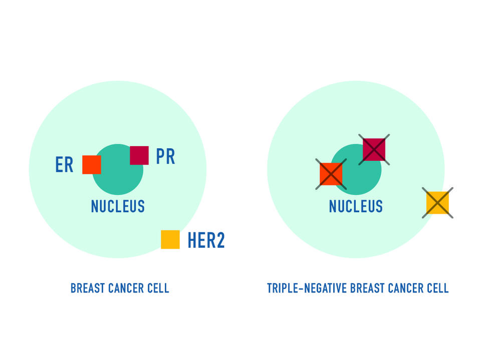 A simplified graphic of two blue cancer cells. On the left, the cell has three receptors highlighted--two in the nucleus and one on the cell's edge.  On the right, these receptors have X symbols over them.