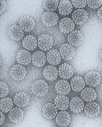 Electron microscopy of HPV particles