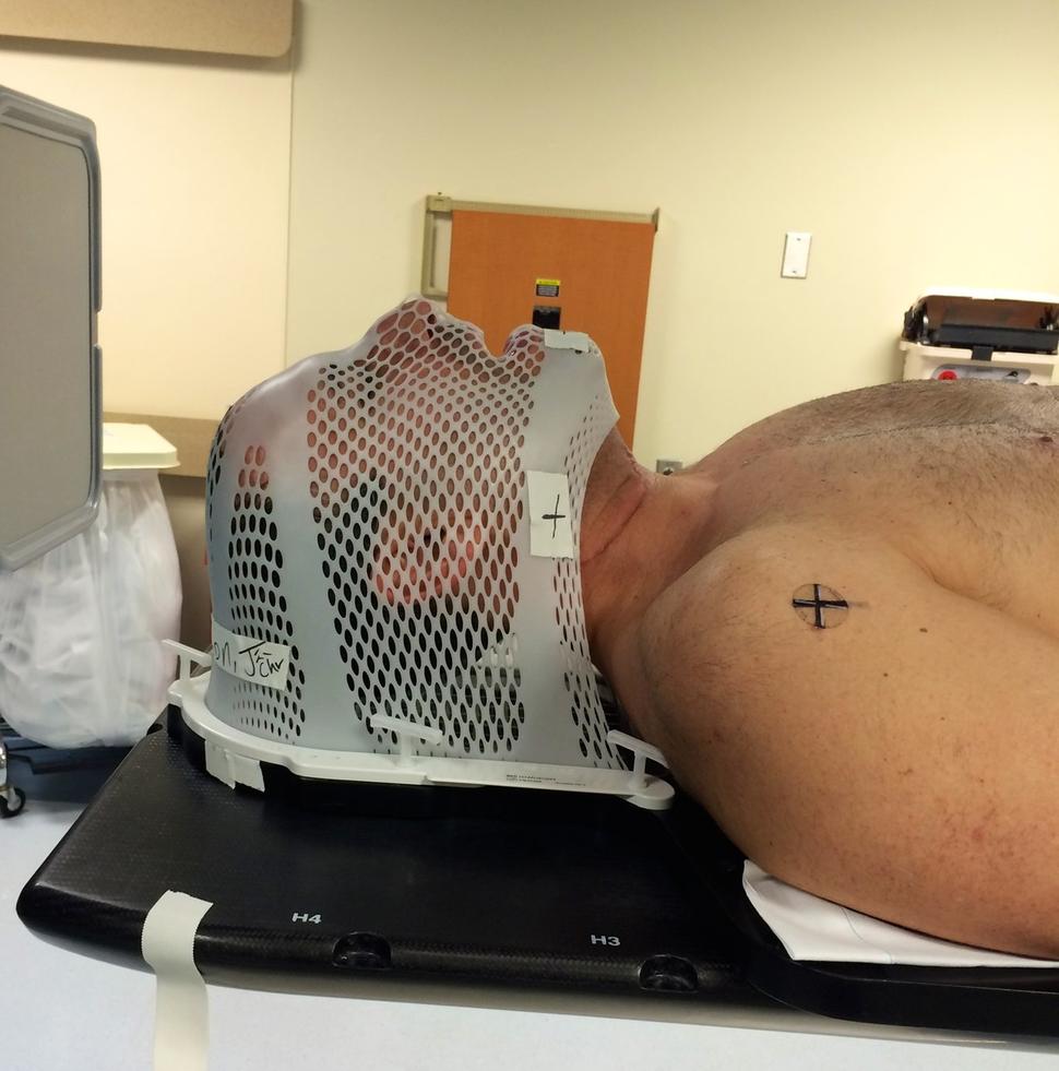 Jason Mendelsohn in the hospital with medical netting over his head, prior to a radiation treatment.