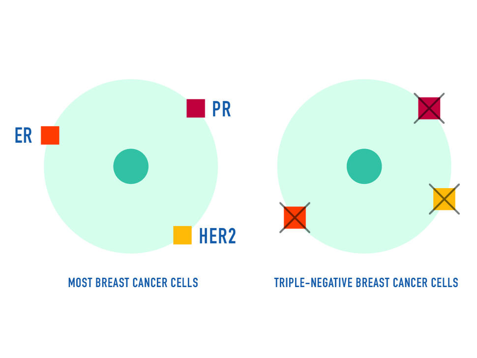 Illustration of a breast cancer tumor cell with and without the estrogen and progesterone receptors and the HER2 protein.