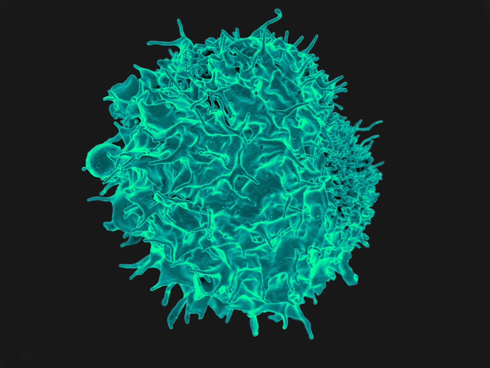 Imagen microscópica tridimensional del exterior de una célula T con protuberancias onduladas. La célula está teñida de verde.