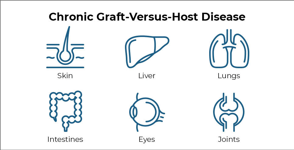 Text reading chronic graft-versus-host disease, followed by icons of six organs-skin, liver, lungs, intestines, eyes, and joints.