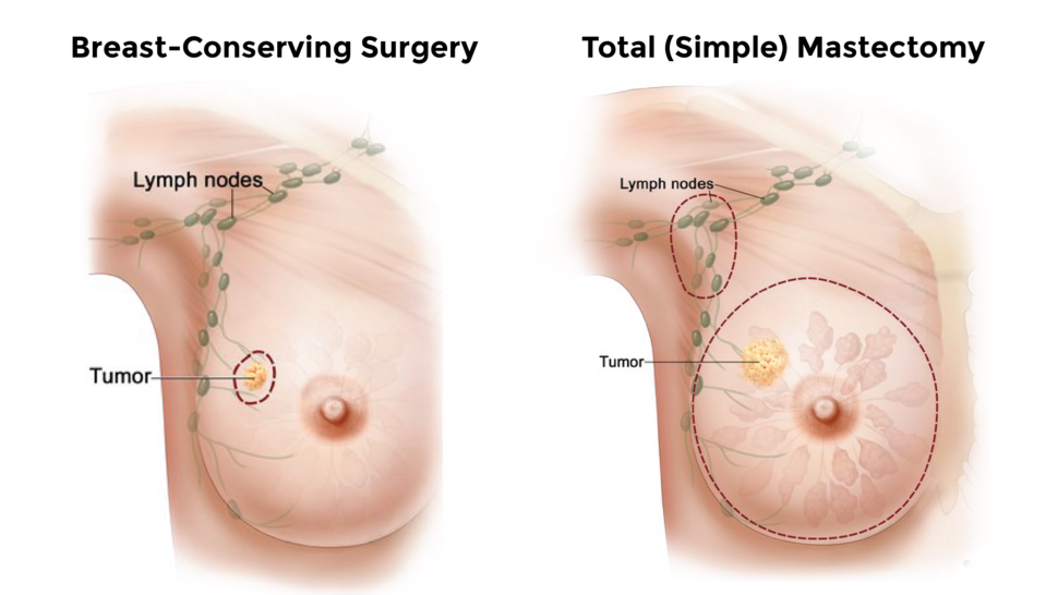 There are different nine types of boobs and this is what they look like