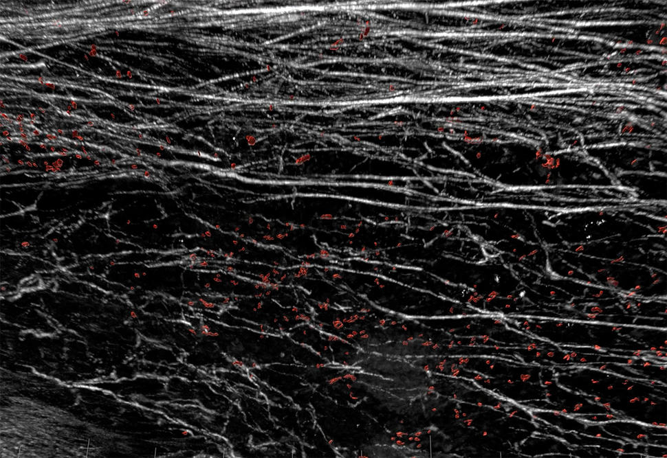 Image of white fiber structures and red cells on black background