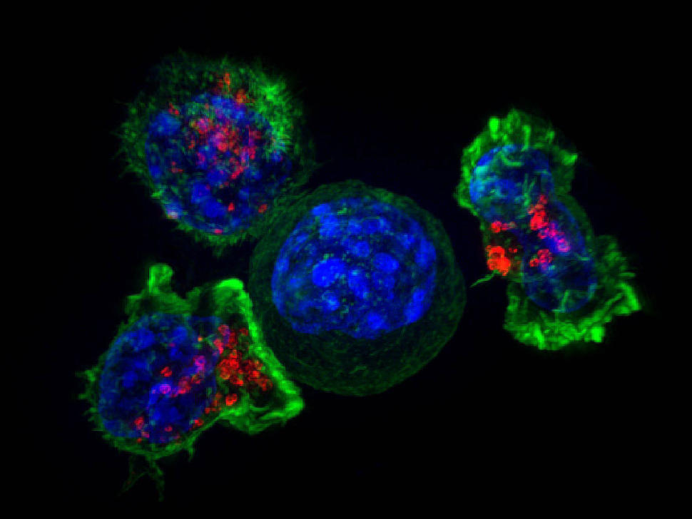 A super resolution image of killer T cells, stained in green and red, surrounding a cancer cell, stained in blue.