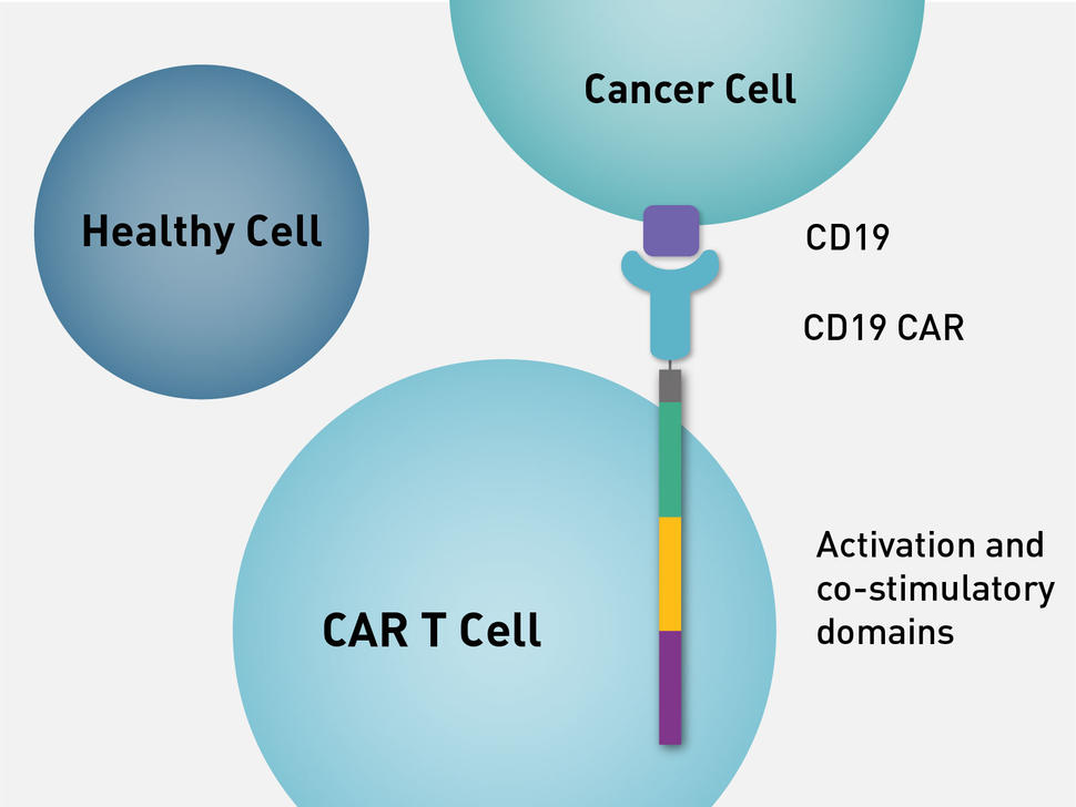 CAR T Cells: Second-Line Treatment Option for NHL? - NCI