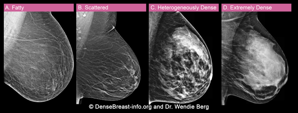 Synonyms for Breasts starting with letter D